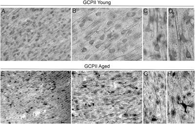 Glutamate Carboxypeptidase II in Aging Rat Prefrontal Cortex Impairs Working Memory Performance